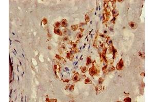 Immunohistochemistry of paraffin-embedded human placenta tissue using ABIN7147067 at dilution of 1:100