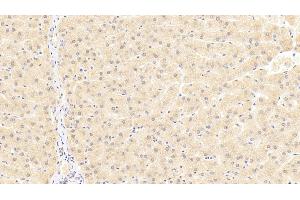 Detection of TRAF6 in Human Liver Tissue using Polyclonal Antibody to TNF Receptor Associated Factor 6 (TRAF6) (TRAF6 anticorps  (AA 153-423))