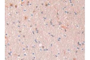 IHC-P analysis of Human Liver Tissue, with DAB staining. (SERPINA1 anticorps  (AA 25-418))