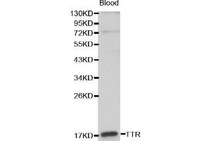 Western blot analysis of Blood cell lysate using TTR antibody. (TTR anticorps  (AA 21-147))