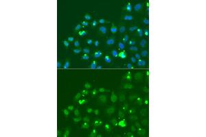 Immunofluorescence analysis of A549 cells using ATF3 antibody (ABIN6290025). (ATF3 anticorps)