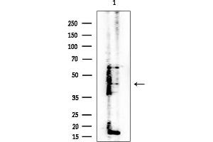 anti-Tripartite Motif Containing 29 (TRIM29) (Internal Region) antibody