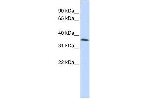 C8orf70 antibody used at 2. (FAM164A anticorps  (Middle Region))