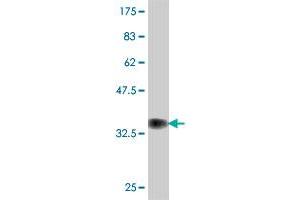 Western Blot detection against Immunogen (37.
