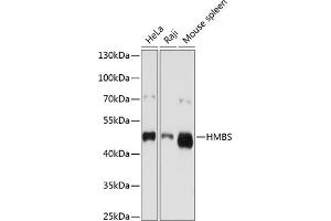 Western blot analysis of extracts of various cell lines, using HMBS antibody (ABIN3022529, ABIN3022530, ABIN3022531 and ABIN6218882) at 1:1000 dilution. (HMBS anticorps  (AA 1-361))
