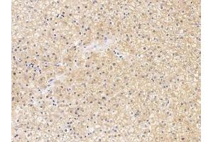 Detection of CLDN1 in Human Liver Tissue using Polyclonal Antibody to Claudin 1 (CLDN1)