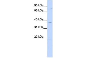 anti-Zinc Finger Protein 264 (ZNF264) (N-Term) antibody