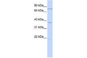 WB Suggested Anti-ZNF264 Antibody Titration:  0. (ZNF264 anticorps  (N-Term))