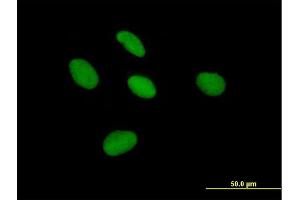 Immunofluorescence of purified MaxPab antibody to TCEA3 on HepG2 cell.