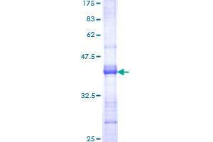 Image no. 1 for Deleted in Malignant Brain Tumors 1 (DMBT1) (AA 1377-1485) protein (GST tag) (ABIN1351710)