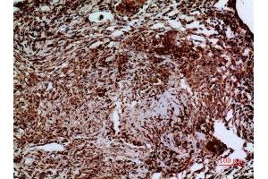 Immunohistochemistry (IHC) analysis of paraffin-embedded Human Lung, antibody was diluted at 1:100.
