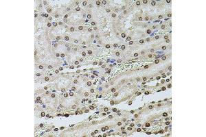 Immunohistochemistry of paraffin-embedded rat kidney using HIST1H2AG antibody (ABIN6003627) at dilution of 1/100 (40x lens).