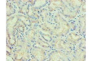 Immunohistochemical of paraffin-embedded human kidney tissue using ABIN7176818 at dilution of 1:200. (PLA2G7 anticorps)