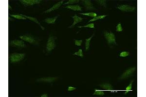 Immunofluorescence of monoclonal antibody to SCYE1 on HeLa cell.