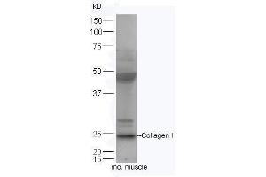 Western Blotting (WB) image for anti-Collagen, Type I (COL1) (AA 1321-1400) antibody (ABIN670386)