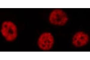 ABIN6275529 staining  Hela cells by IF/ICC.