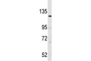 Western blot analysis of LATS1 antibody and K562 lysate.