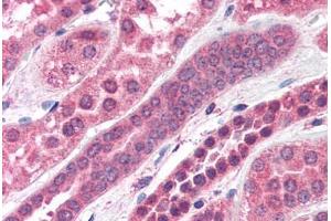 Human Kidney (formalin-fixed, paraffin-embedded) stained with STXBP6 antibody ABIN351472 at 3. (STXBP6 anticorps  (AA 2-14))
