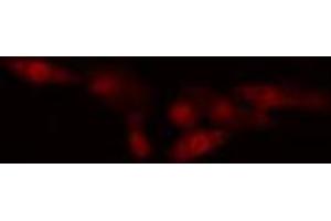 ABIN6274560 staining HeLa cells by IF/ICC. (Spindlin 1 anticorps  (N-Term))