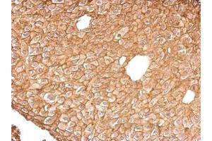 IHC-P Image Annexin IV antibody detects ANXA4 protein at cytosol and membrane on D54MG xenograft by immunohistochemical analysis.