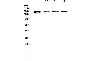 Western blot analysis of SCRIBBLE using anti-SCRIBBLE antibody .