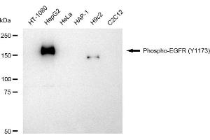 Western blotting analysis using Phospho-EGFR (Y) antibody (ABIN7798469).