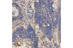 Immunohistochemistry (IHC) image for anti-Chloride Channel 5 (CLCN5) antibody (ABIN1876908) (Chloride Channel 5 anticorps)