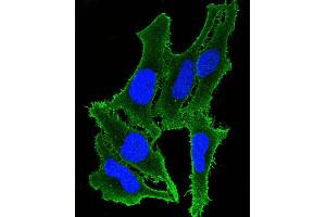 Immunofluorescent analysis of 4 % paraformaldehyde-fixed, 0.