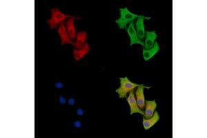 ABIN7096598 and ABIN7100662 staining HepG2 cells by IF/ICC. (Fascin 2 anticorps)