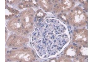 DAB staining on IHC-P; Samples: Human Kidney Tissue (PC anticorps  (AA 36-486))