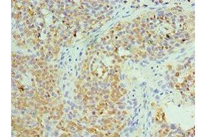 Immunohistochemistry of paraffin-embedded human tonsil tissue using ABIN7171432 at dilution of 1:100