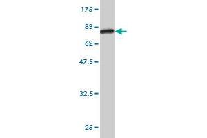 Western Blot detection against Immunogen (72.