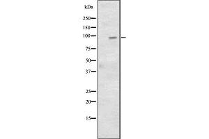 Western blot analysis of CD97 expression in HepG2 whole cell lysate; HCT116 whole cell lysate;,The lane on the left is treated with the antigen-specific peptide.