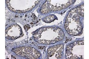 IHC testing of FFPE human testis tissue with GSTM3 antibody at 1ug/ml. (GSTM3 anticorps)