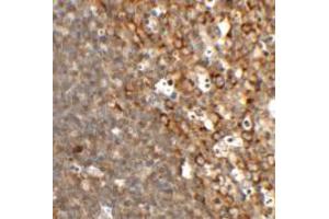 Immunohistochemistry of TFCP2L1 in rat colon tissue with TFCP2L1 antibody at 2. (TFCP2L1 anticorps  (N-Term))