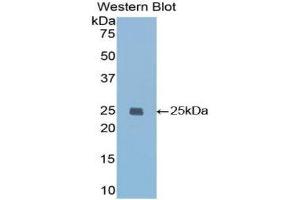 Western Blotting (WB) image for anti-Insulin-Like Growth Factor Binding Protein 7 (IGFBP7) (AA 88-281) antibody (ABIN1859314) (IGFBP7 anticorps  (AA 88-281))