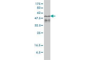 ZFYVE19 monoclonal antibody (M01), clone 4D5-2D11 Western Blot analysis of ZFYVE19 expression in PLC/PRF/5 . (ZFYVE19 anticorps  (AA 1-396))
