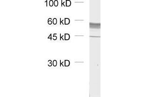 dilution: 1 : 1000, sample: unboiled synaptic membrane fraction of rat brain (LP1) (GABRB1 anticorps  (AA 342-430))