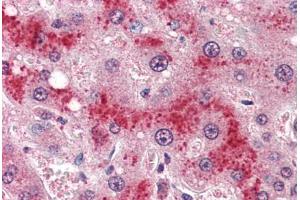 Human Liver (formalin-fixed, paraffin-embedded) stained with LEPR antibody ABIN364407 at 4 ug/ml followed by biotinylated anti-goat IgG secondary antibody ABIN481715, alkaline phosphatase-streptavidin and chromogen. (Leptin Receptor anticorps  (AA 829-841))