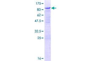 Image no. 1 for Neural Wiskott-Aldrich syndrome protein (WASL) (AA 1-505) protein (GST tag) (ABIN1325163)
