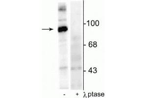 Western blot of rat hippocampal lysate stimulated with forskolin showing specific immunolabeling of the ~95 kDa dynamin phosphorylated at Ser774 in the first lane (-).