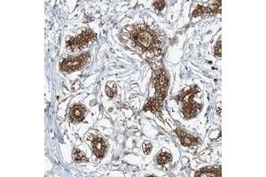 Immunohistochemical staining of human breast with COMMD8 polyclonal antibody  strong cytoplasmic positivity in glandular cells at 1:50-1:200 dilution.