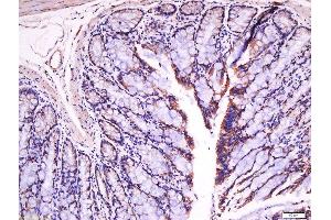 Paraformaldehyde-fixed, paraffin embedded rat intestine tissue, Antigen retrieval by boiling in sodium citrate buffer(pH6) for 15min, Block endogenous peroxidase by 3% hydrogen peroxide for 30 minutes, Blocking buffer (normal goat serum) at 37°C for 20min, Antibody incubation with Rabbit Anti-Fibronectin Polyclonal Antibody, Unconjugated  at 1:500 overnight at 4°C, followed by a conjugated secondary and DAB staining