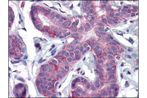 Immunohistochemistry Image: Human Breast: Formalin-Fixed, Paraffin-Embedded (FFPE) (PPARD anticorps  (C-Term))