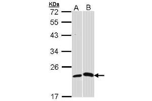 WB Image Sample (30 ug of whole cell lysate) A: H1299 B: Molt-4 , 12% SDS PAGE antibody diluted at 1:1000 (CRP anticorps)