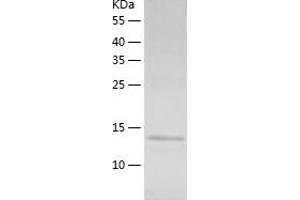 Western Blotting (WB) image for Adiponectin (ADIPOQ) (AA 111-247) protein (His tag) (ABIN7121726) (ADIPOQ Protein (AA 111-247) (His tag))