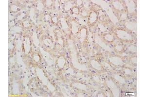Formalin-fixed and paraffin embedded mouse kidney labeled with Rabbit Anti SARM1 Polyclonal Antibody, Unconjugated (ABIN1387556) at 1:200 followed by conjugation to the secondary antibody and DAB staining (SARM1 anticorps  (AA 340-380))
