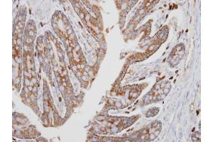 IHC-P Image Immunohistochemical analysis of paraffin-embedded human colon, using PKA alpha, antibody at 1:100 dilution. (PRKACA anticorps  (Center))