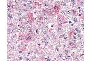 Anti-MKP-8 / DUSP26 antibody IHC of human liver. (DUSP26 anticorps  (Internal Region))