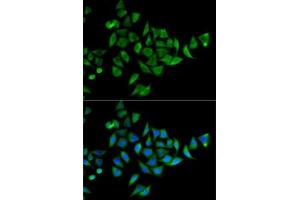 Immunofluorescence analysis of HeLa cells using DOK1 antibody (ABIN6130881, ABIN6139763, ABIN6139764 and ABIN6221343).
